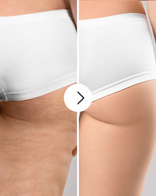 Cellinea celiulito ir odos būklę gerinančios tabletės su natūraliais ekstraktais (60 kapsulių)_3 - 3