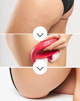 Celloo anticeliulitinis masažuoklis Crush My Celloo su iškilimais kovoja su celiulitu ir mažina raumenų įtampą