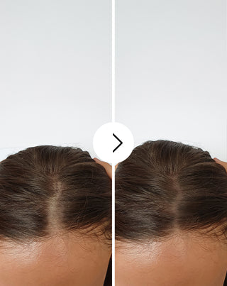 Follixin kapsulės nuo plaukų slinkimo su tankinančiu ir stiprinančiu efektu (60 kapsulių)_2 - 2