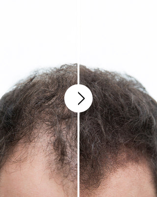 Follixin kapsulės nuo plaukų slinkimo su tankinančiu ir stiprinančiu efektu (60 kapsulių)_4 - 4