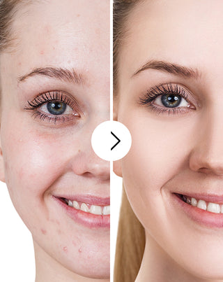 Derminax tabletės nuo spuogų, inkštirų ir netobulumų su cinku, vitaminu C, E ir B2_5 - 5