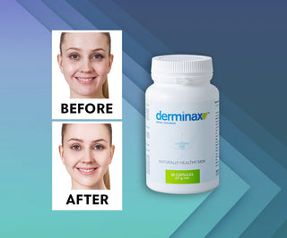 Derminax tabletės nuo spuogų, inkštirų ir netobulumų su cinku, vitaminu C, E ir B2 - 2
